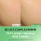 Picture of Torriden Balanceful Cica Serum: Unlock Your Skin's True Potential with Soothing Hydration
