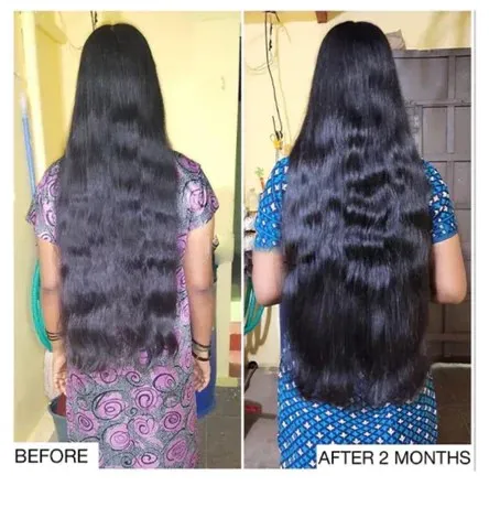 زيت 108 عشبة الأصلي الهندي قبل وبعد